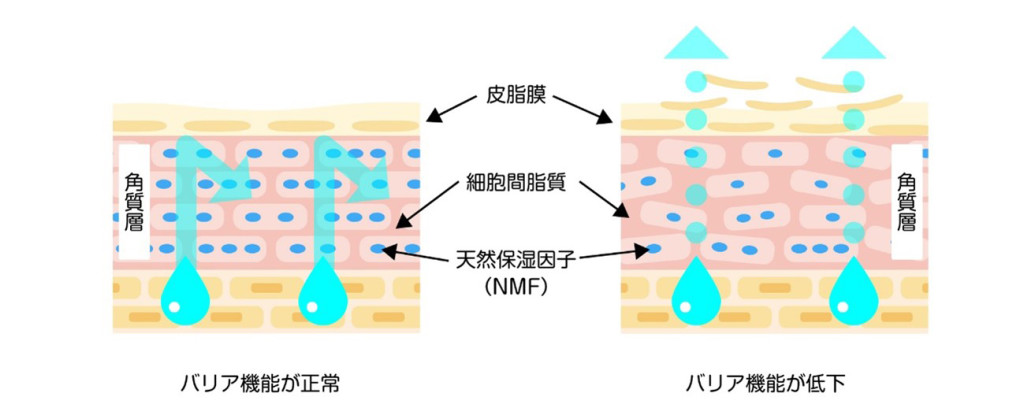 医師監修 ザラザラする乾燥肌の原因とは 知っておきたい対処法も解説 健栄生活