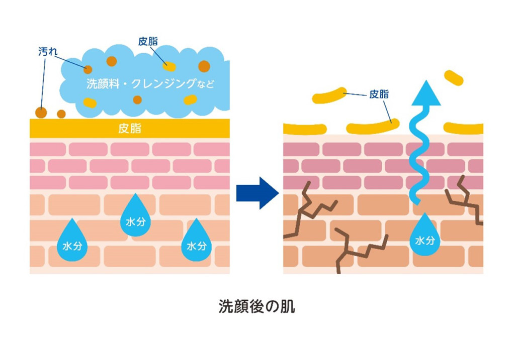 医師監修 洗顔後につっぱるのは乾燥肌が原因 正しいスキンケア方法についても解説 健栄生活